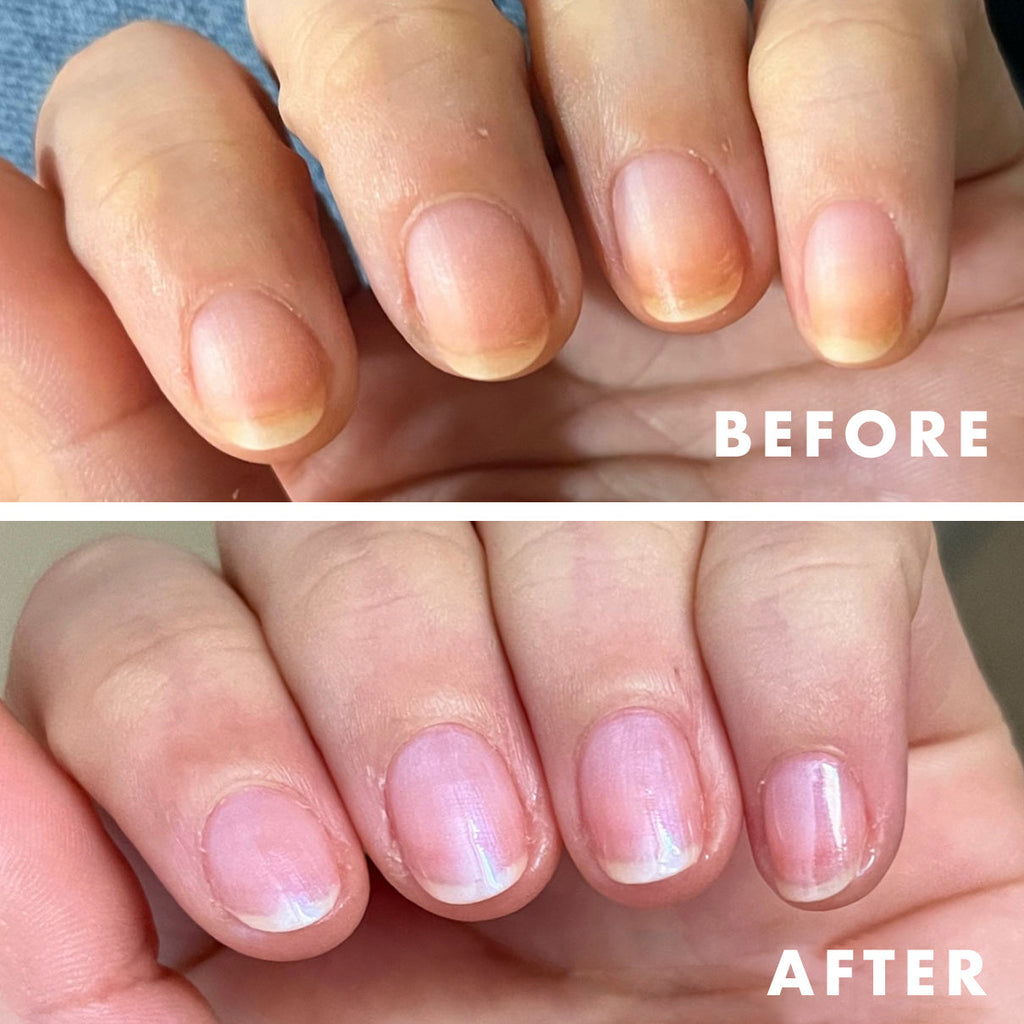 before and after